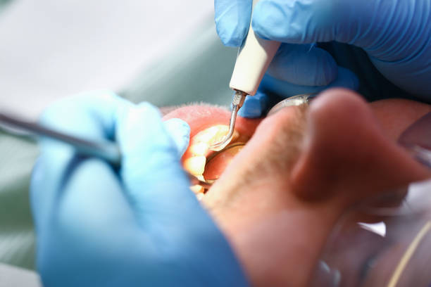 Best Orthodontic Emergency Dentist in Cedar Bluff, VA