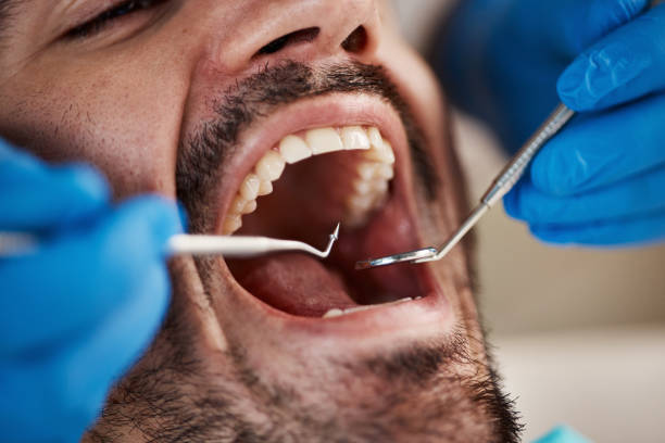 Best Emergency Dental Extractions in Cedar Bluff, VA