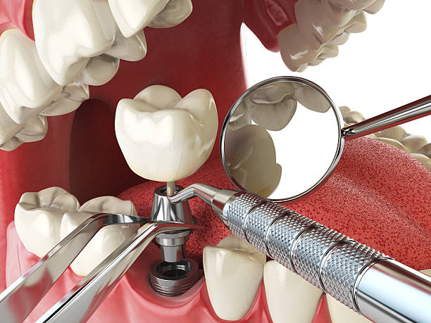 Best Pediatric Emergency Dentist in Cedar Bluff, VA